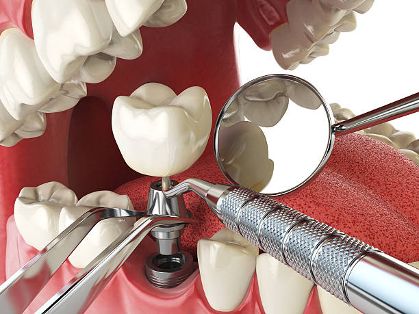 Emergency Gum Pain Relief in NC
